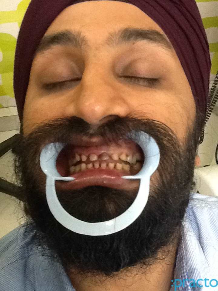 Dental Flights South City-I Gurgaon