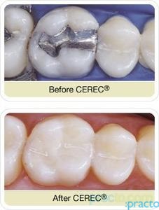 Chinthamani Laser Dental Clinic & Implant Centre Porur Chennai
