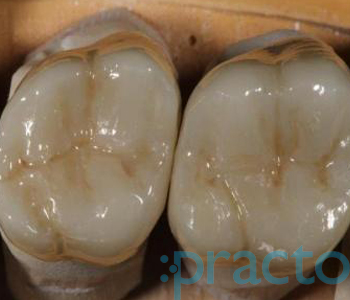 Dhanwanth Dental Care Chintadripet Chennai