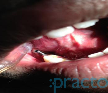 Dhanwanth Dental Care Chintadripet Chennai