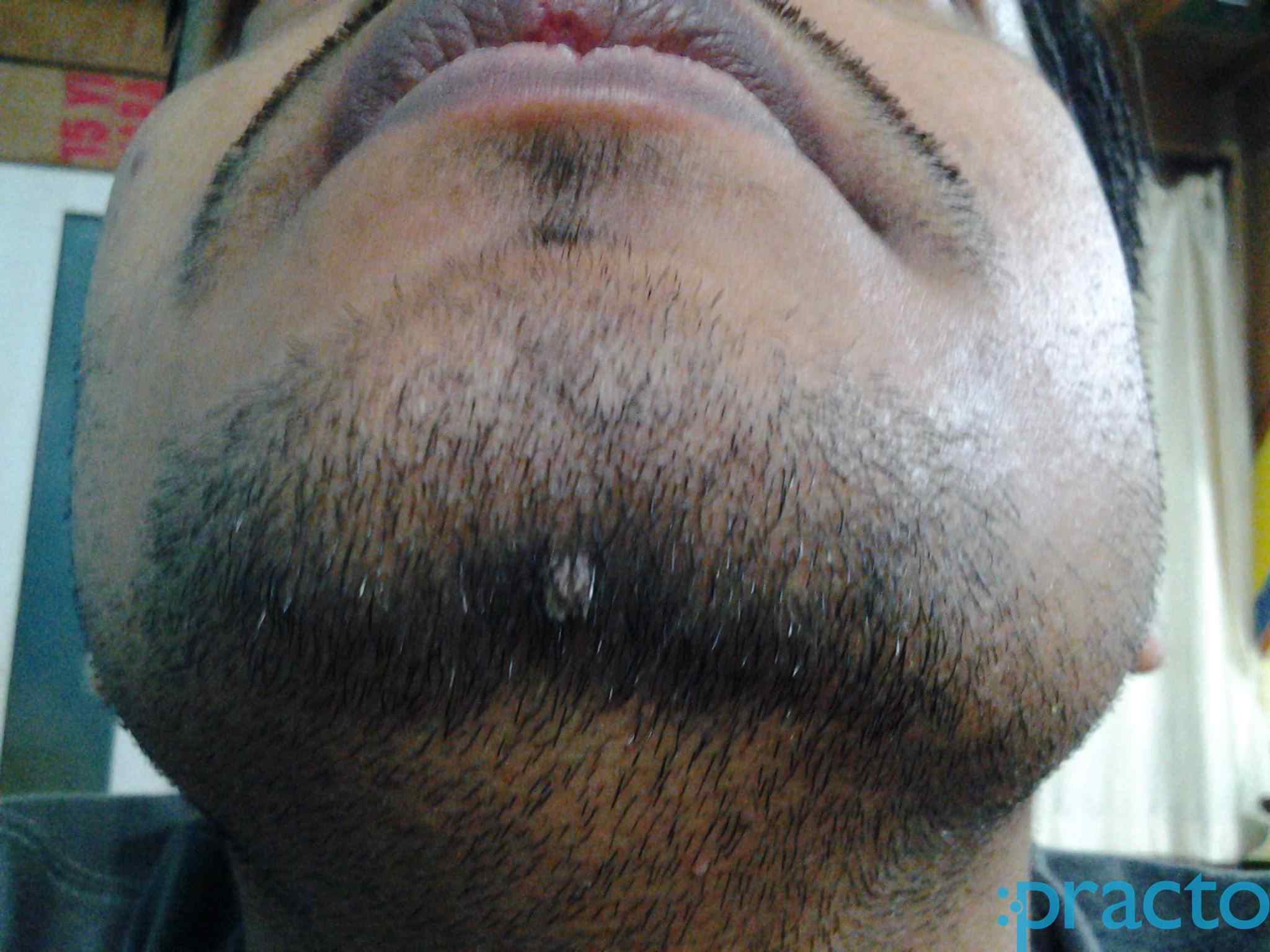 Mahalakshmi Advance Homoeopathy Clinic Vishrantwadi Pune