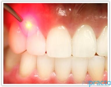 Chinthamani Laser Dental Clinic & Implant Centre Porur Chennai