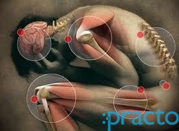 Bhaskara Physiotherapy And Pain Mangament Centre in Hyderabad Ameerpet Hyderabad